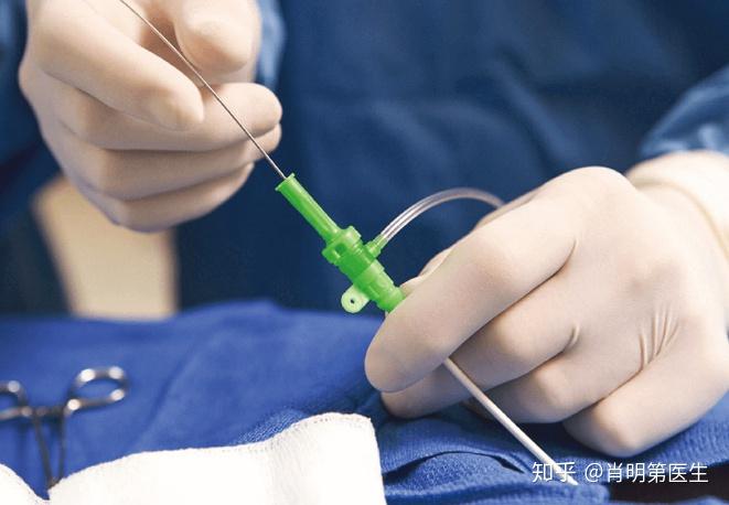 心导管检查及应用