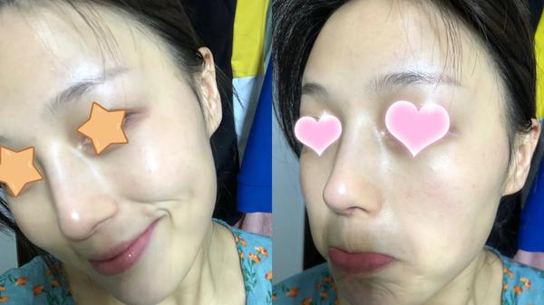 孕妇该如何护肤保养_护肤保养步骤_孕妇护肤保养