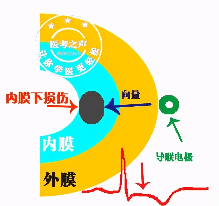 星医百学习心电图这是我见过最牛的文章