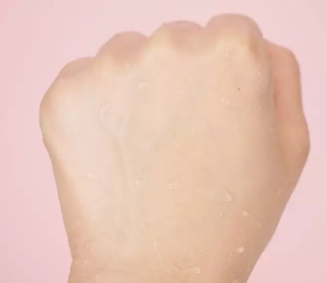 油性痘痘肌适合用什么防晒霜?