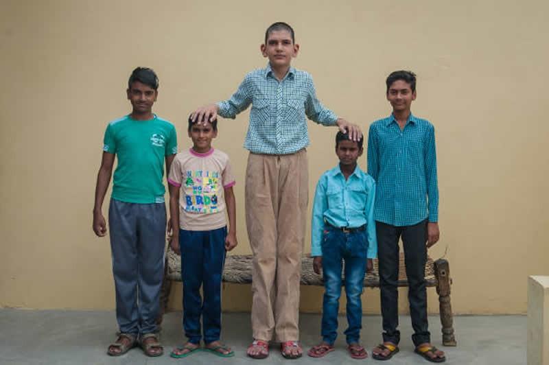 印度8岁男童身高1米98长大后想打篮球他为啥能长这么高