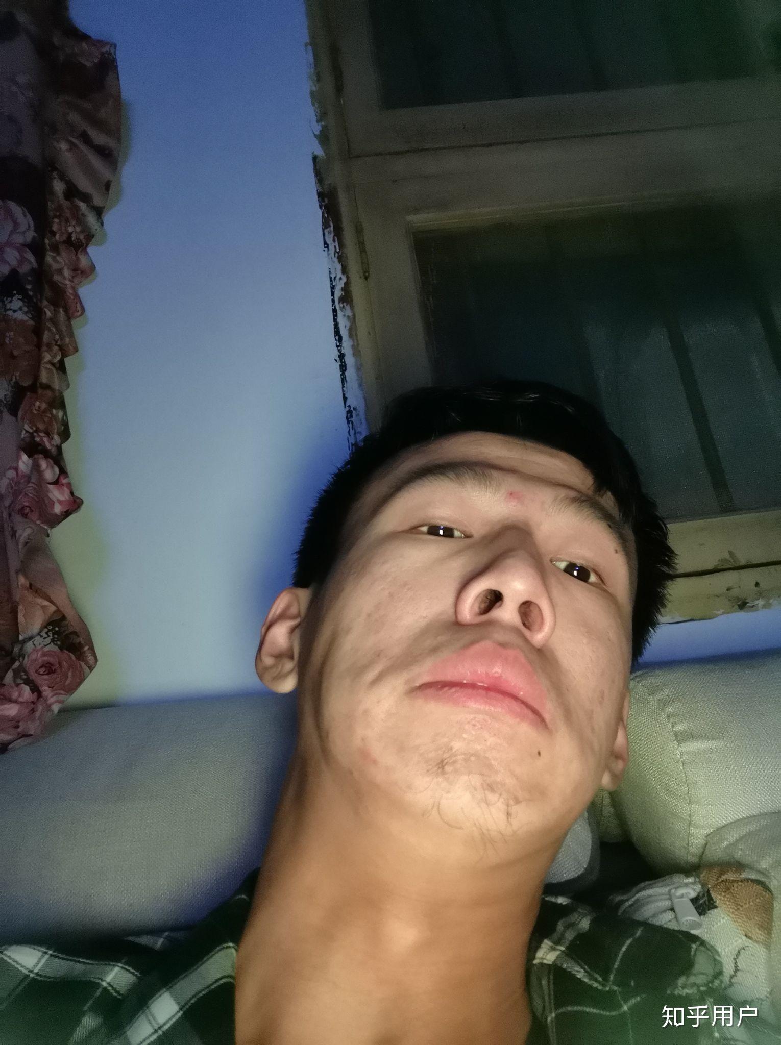 男生长得特别特别的丑特别特别的难看是什么体验