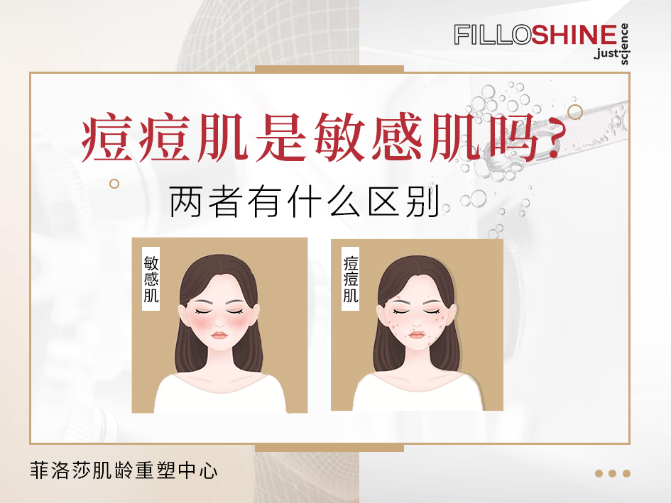 v2-69f0eec1cf58b2c9b8af0adcc2204d66_1440w.jpg?source=172ae18b