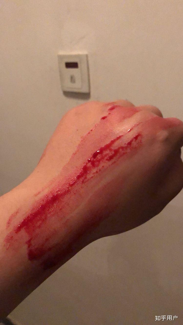 流鼻血鼻衄是怎样的体验