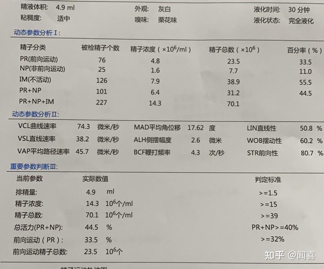 精索静脉曲张手术费图片