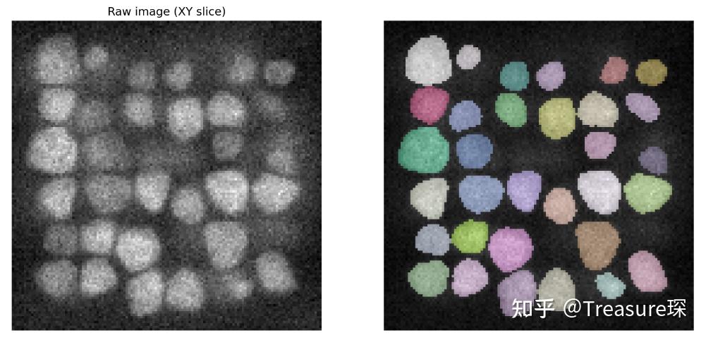 Cellpose——3D细胞分割 - 知乎