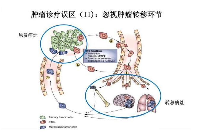 二)忽视了肿瘤的转移环节.