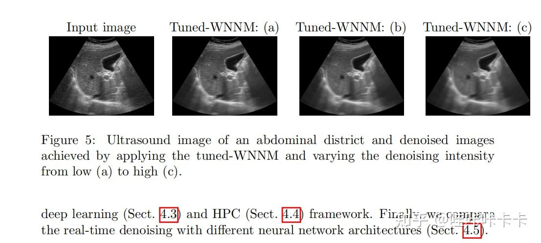 A Universal Deep Learning Framework for Real-Time Denoising of ...