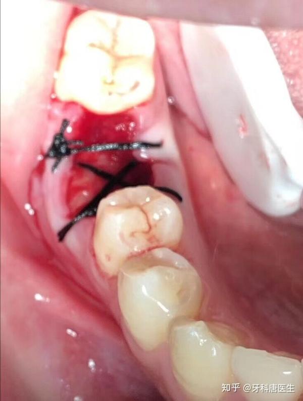 小善能成大爱,小病能成大灾,小事也能显大才.