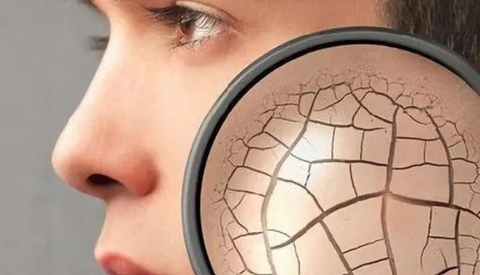 写过一篇详细的文章,大家可移步以上的三种就是"外油内干"的皮肤症状