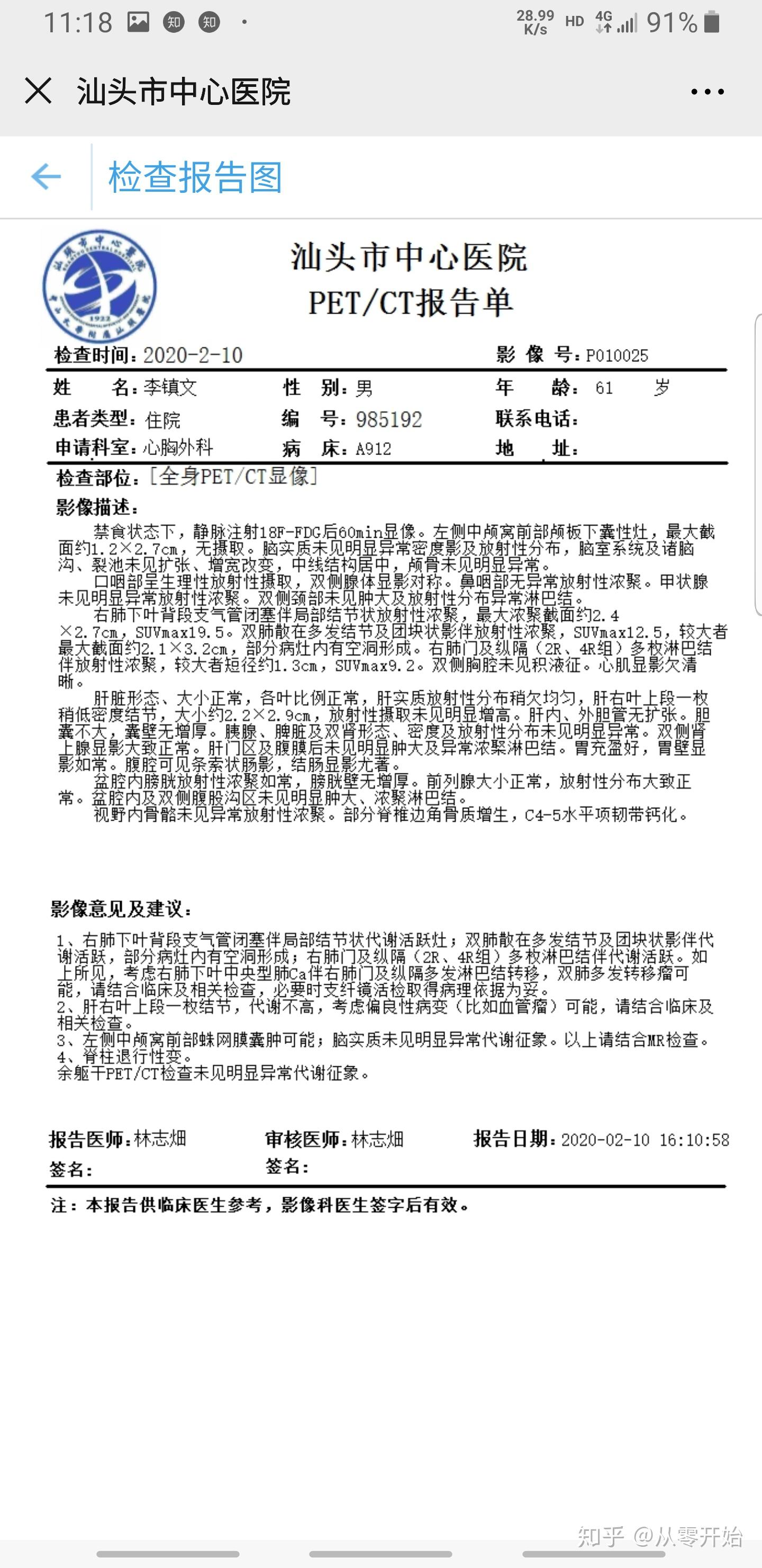 今天活检报告终于出了,肺低分化鳞癌~ - 知乎