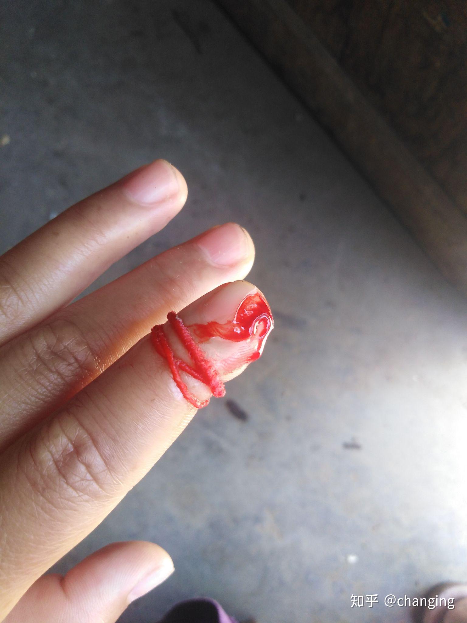 切菜时切到手是一种什么样的体验