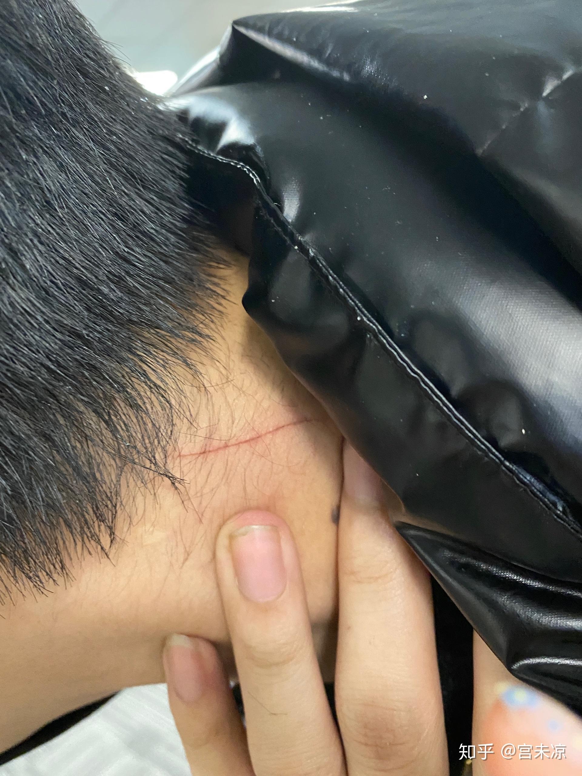今天身上再次出现莫名划痕,求解? - 知乎