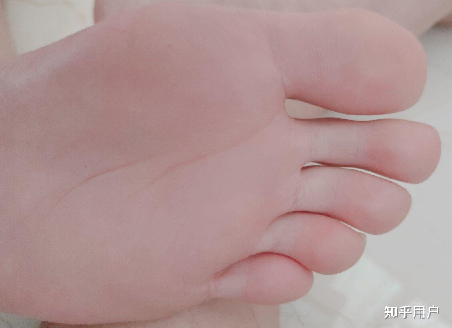 男孩子的脚底很嫩怎么样? - 知乎