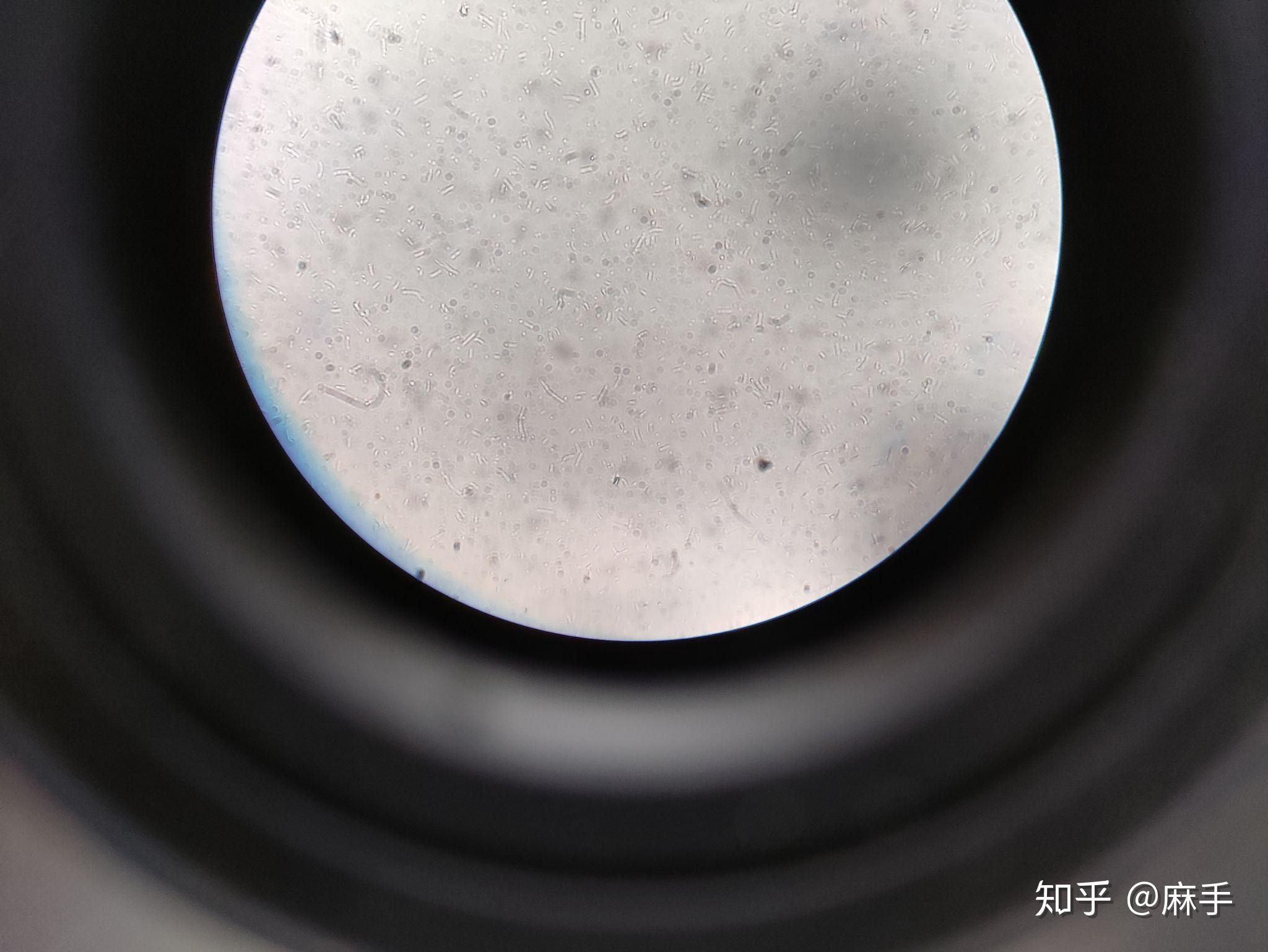 显微镜下的大肠杆菌是什么样子的呢很可爱呢