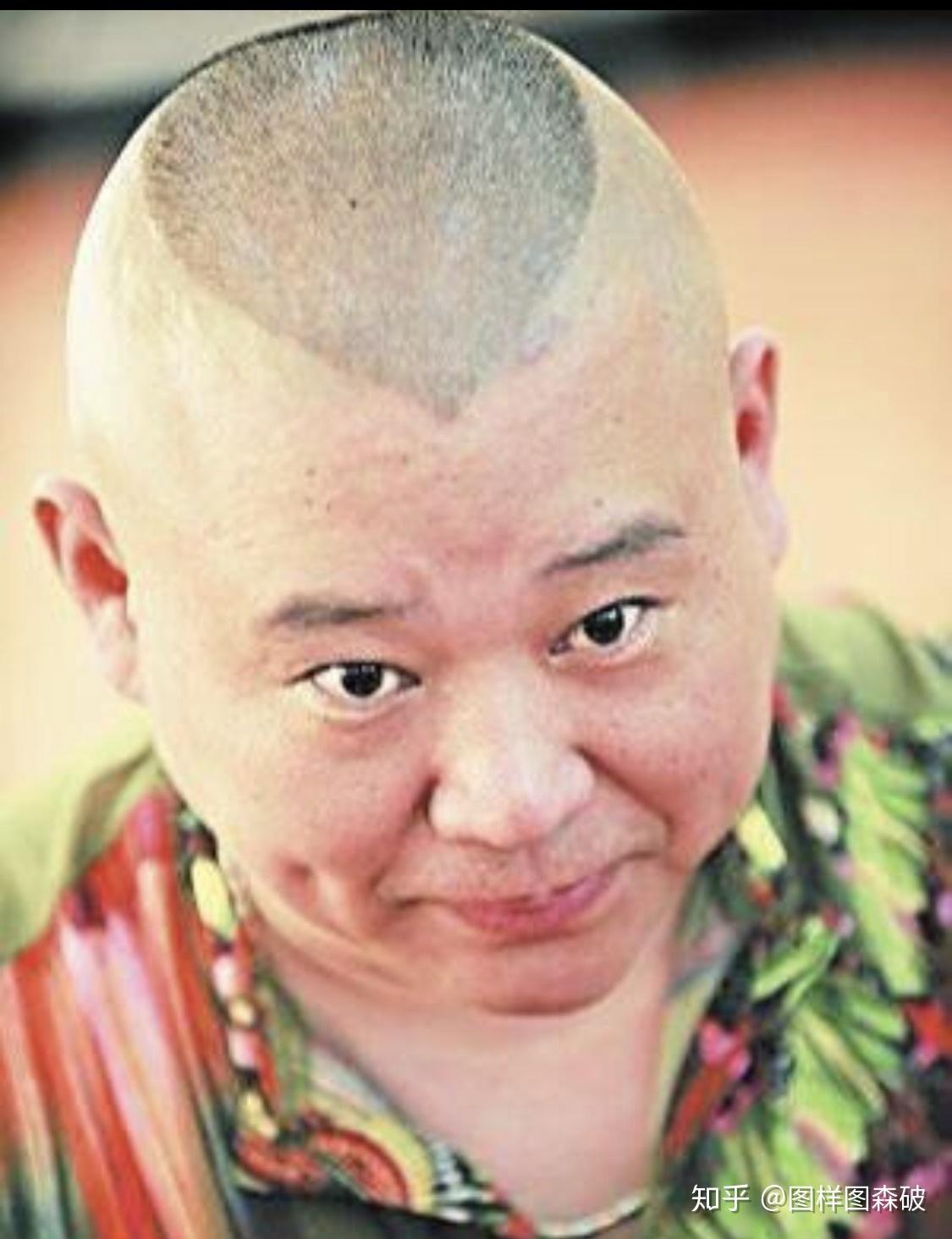 张云雷为什么头发这么多
