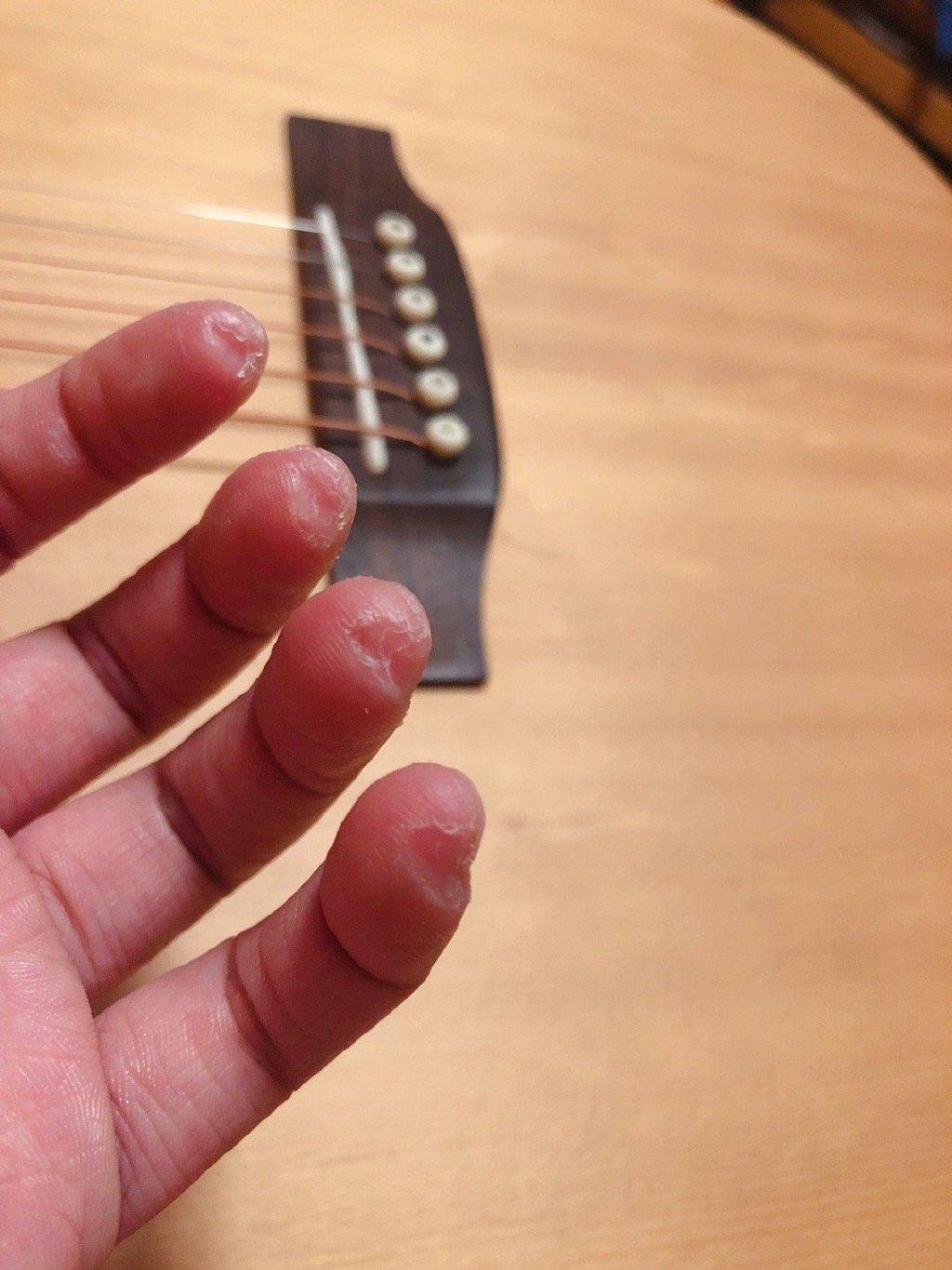 弹吉他手指疼怎么办图片