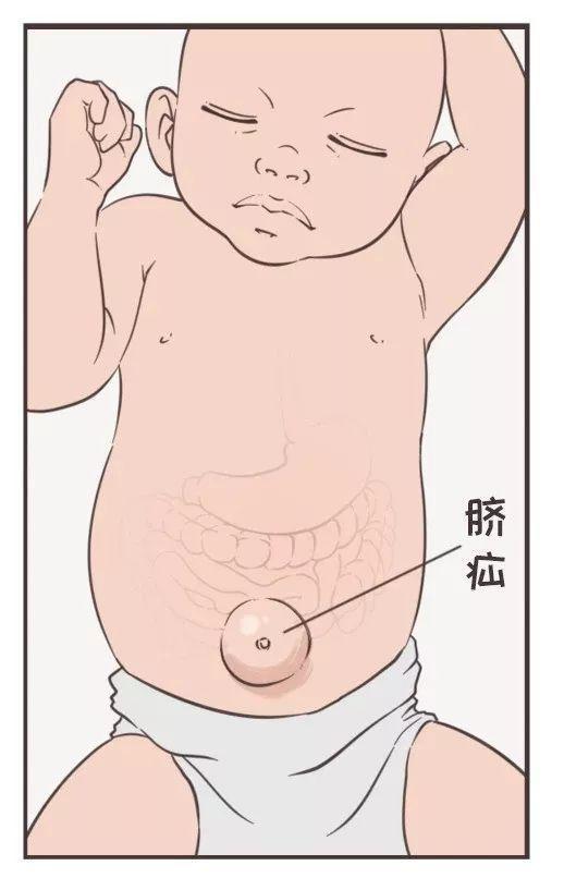 新生儿脐带该怎么护理? 10 v2 6b673cd230525bfe8a1eac880bcf2769 720w