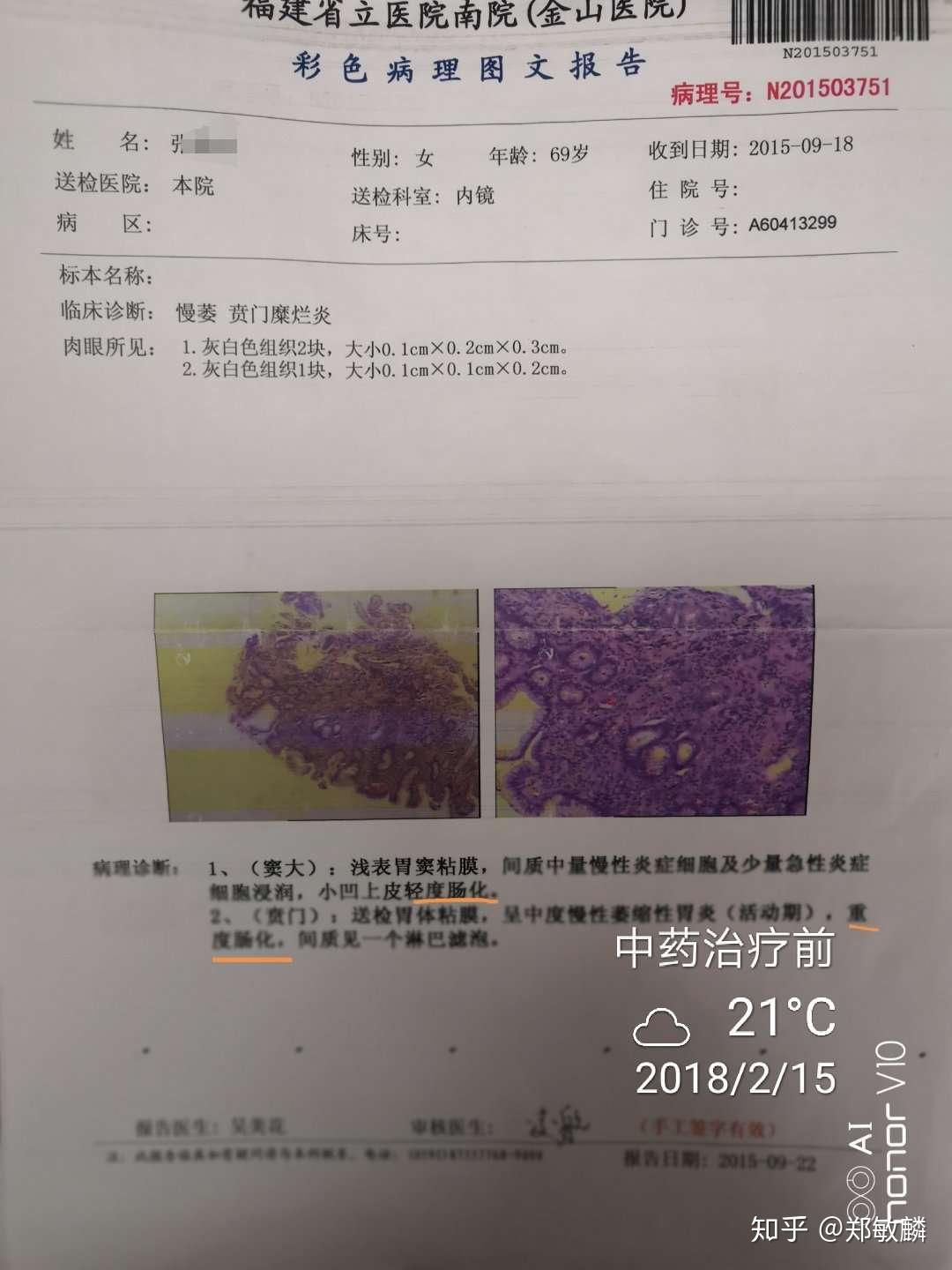 郑敏麟医案萎缩性胃炎伴肠化直肠多发息肉兼失眠案