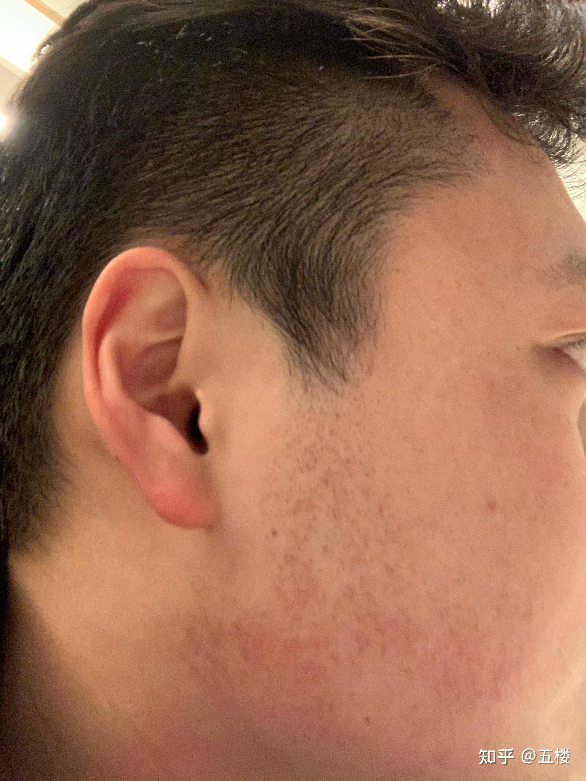 十个男人有五个脸红