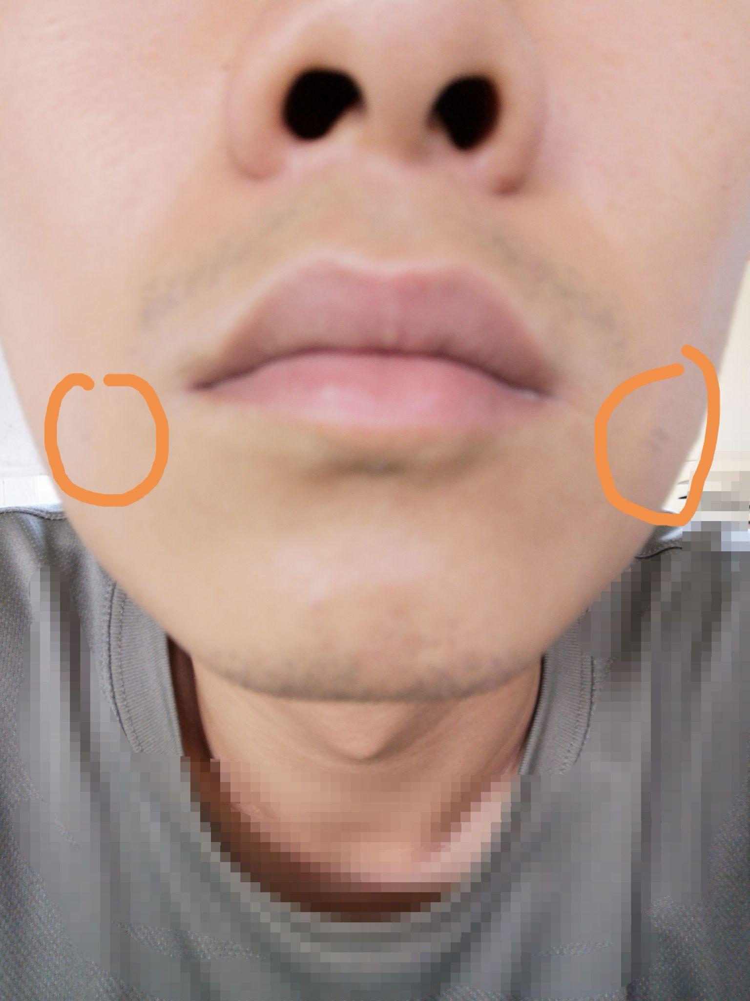 男嘴角两侧长胡子面相图片