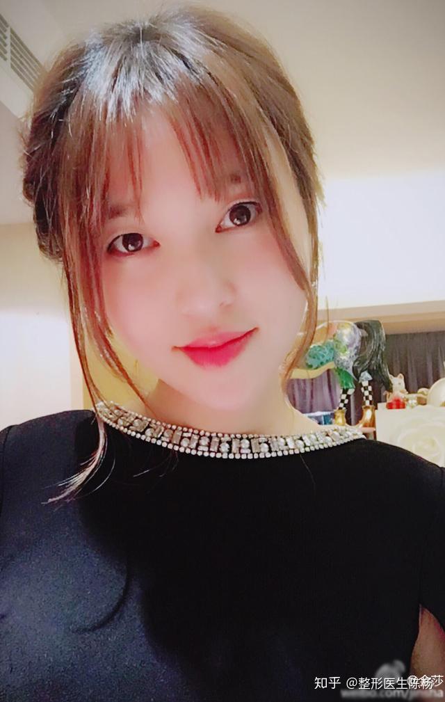 双眼皮可以整成单眼皮吗? - 知乎