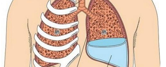 肺积水有哪些表现?致病原因是什么?该如何预防和治疗呢?