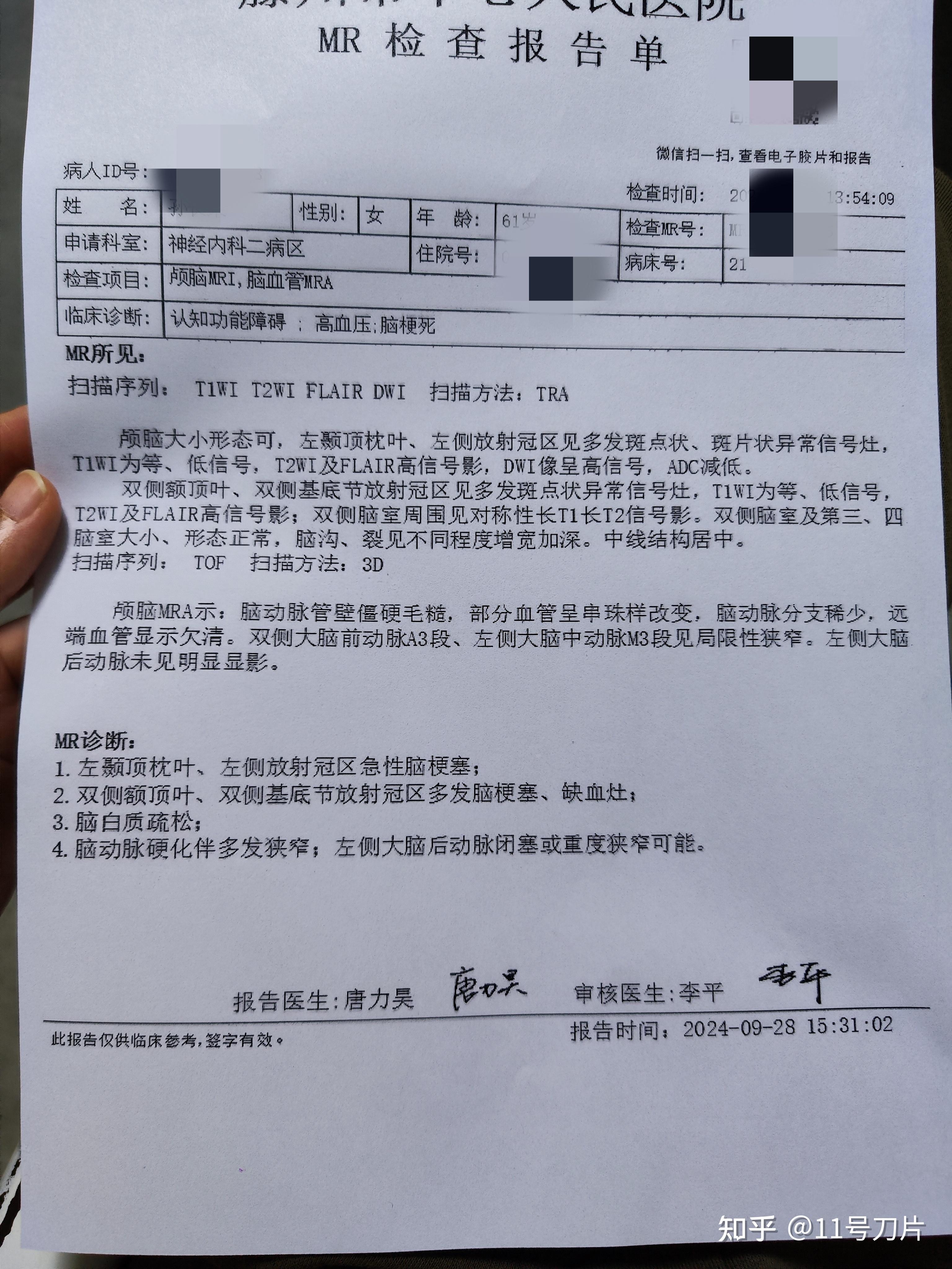 为什么现在脑梗人群越来越多