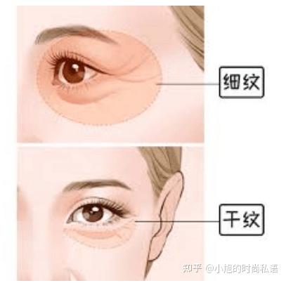 怎么区分眼下干纹和细纹? - 知乎