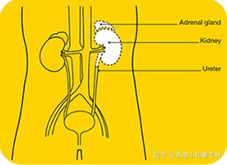 肾癌手术的部分切除与根治性切除的选择 知乎