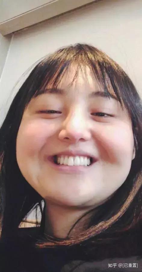 既往的耿直实诚,妥妥的没有偶像包袱,那张死亡角度拍摄的纯素颜大饼脸