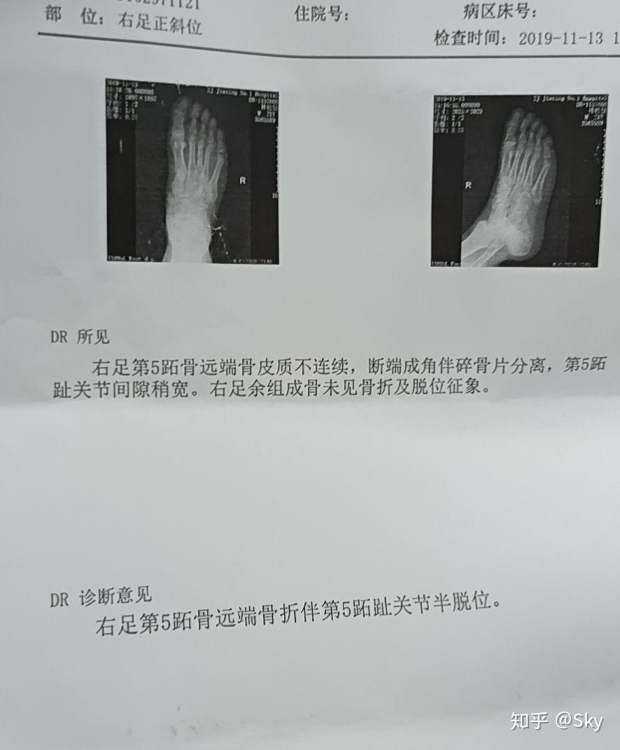 腕关节dr报告模板图片