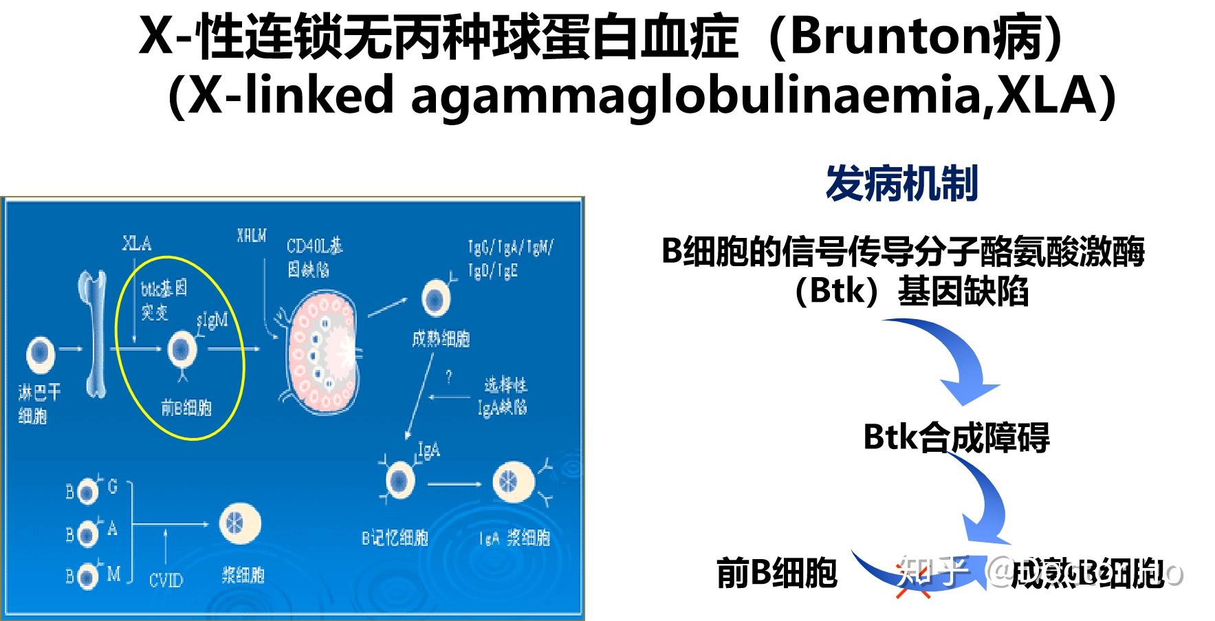 1,免疫缺陷病(immunodeficiency disease, idd)eg:是由免疫系统先天