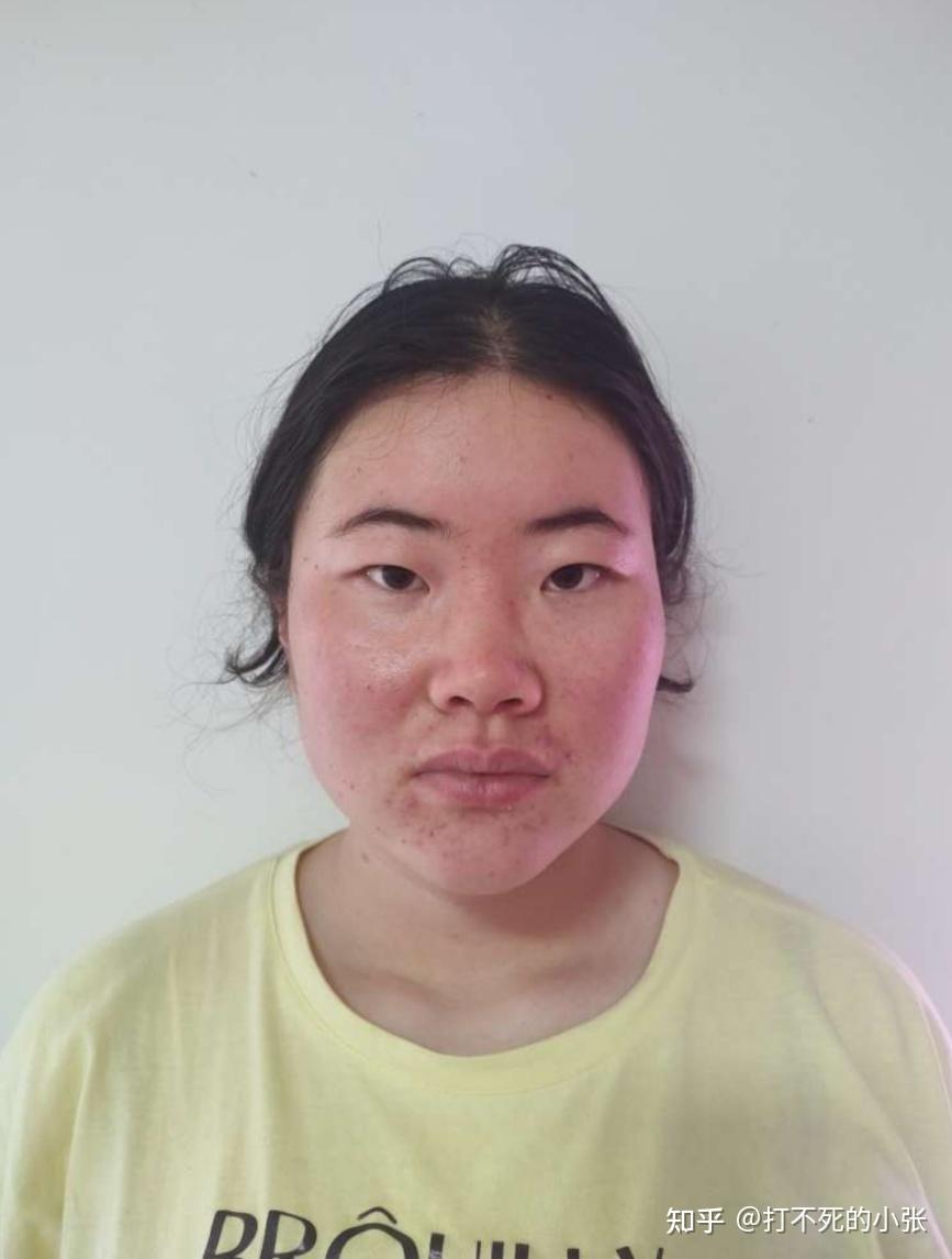 女生长得很丑怎么办超级自卑