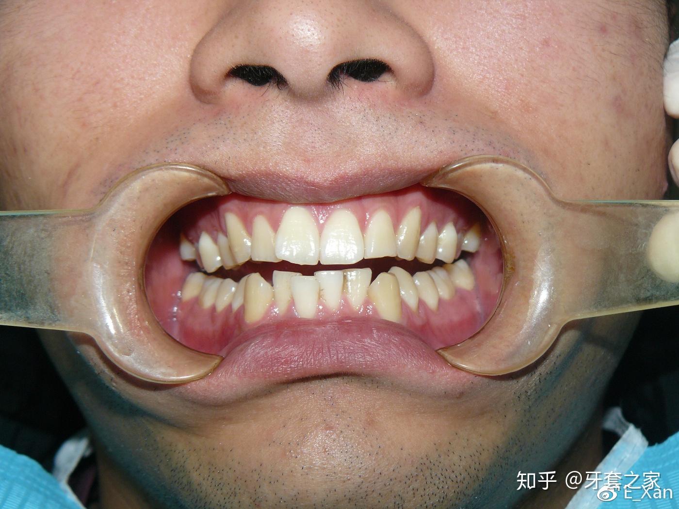 牙齿整齐的男人图片