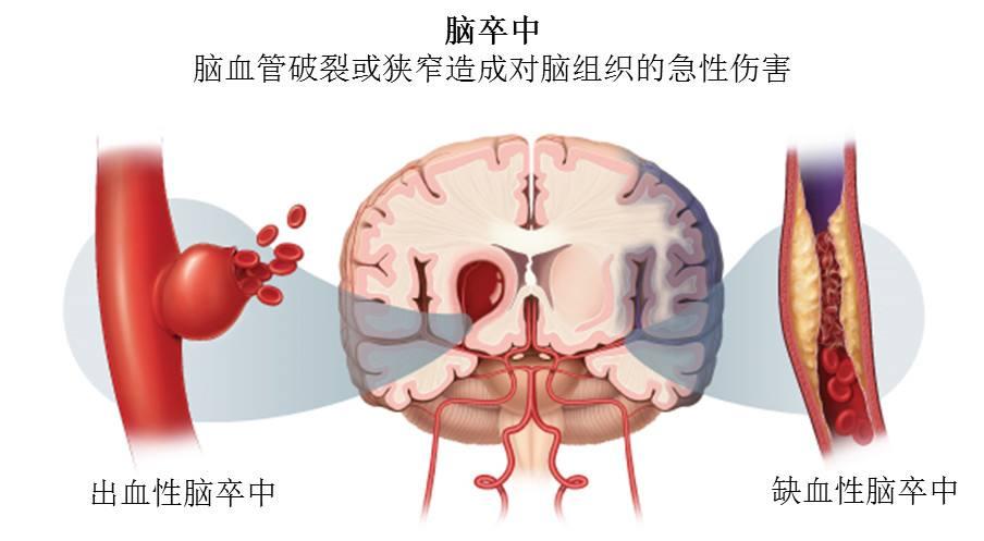 v2-6ccd6951d67b0f4d3185f4e6f25f2df3_1440w.jpg?source=172ae18b