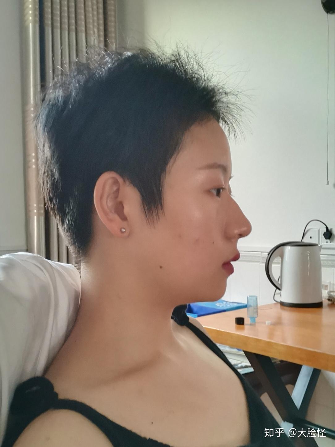 剃光头是否真能改善发质？ - 知乎