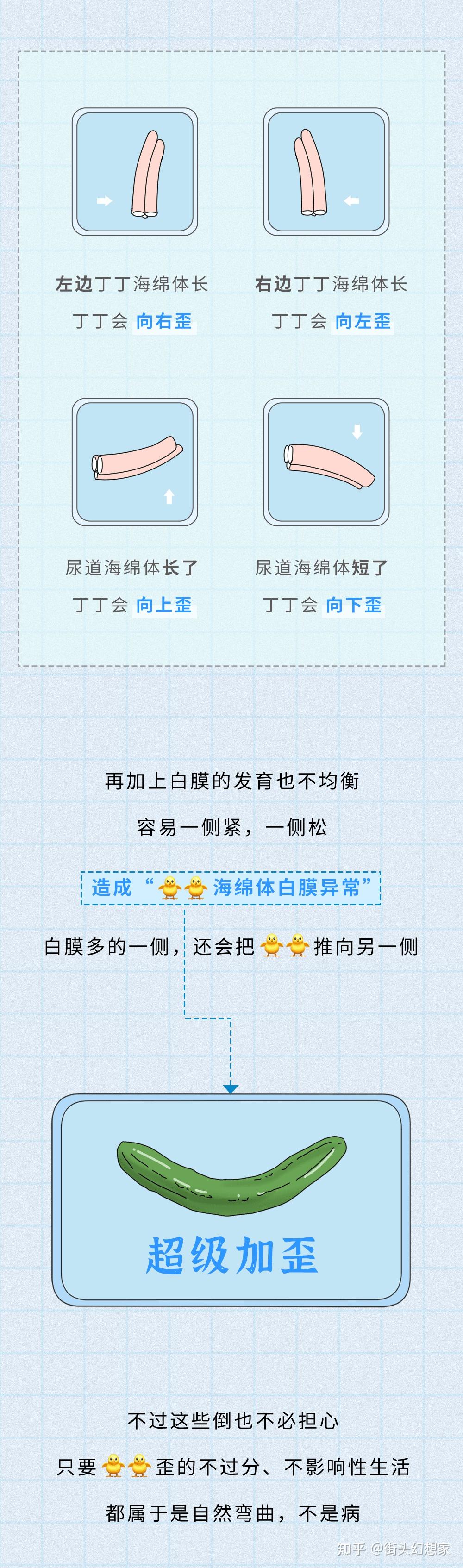 我的丁丁歪了,咋办? - 知乎