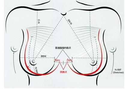 隆胸是不是越大越好