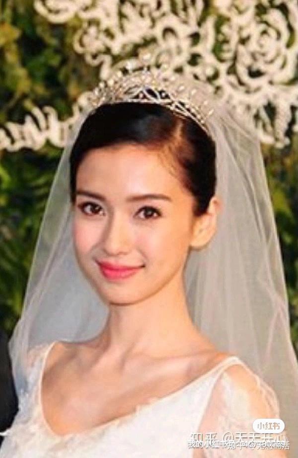 angelababy整容哪些部位