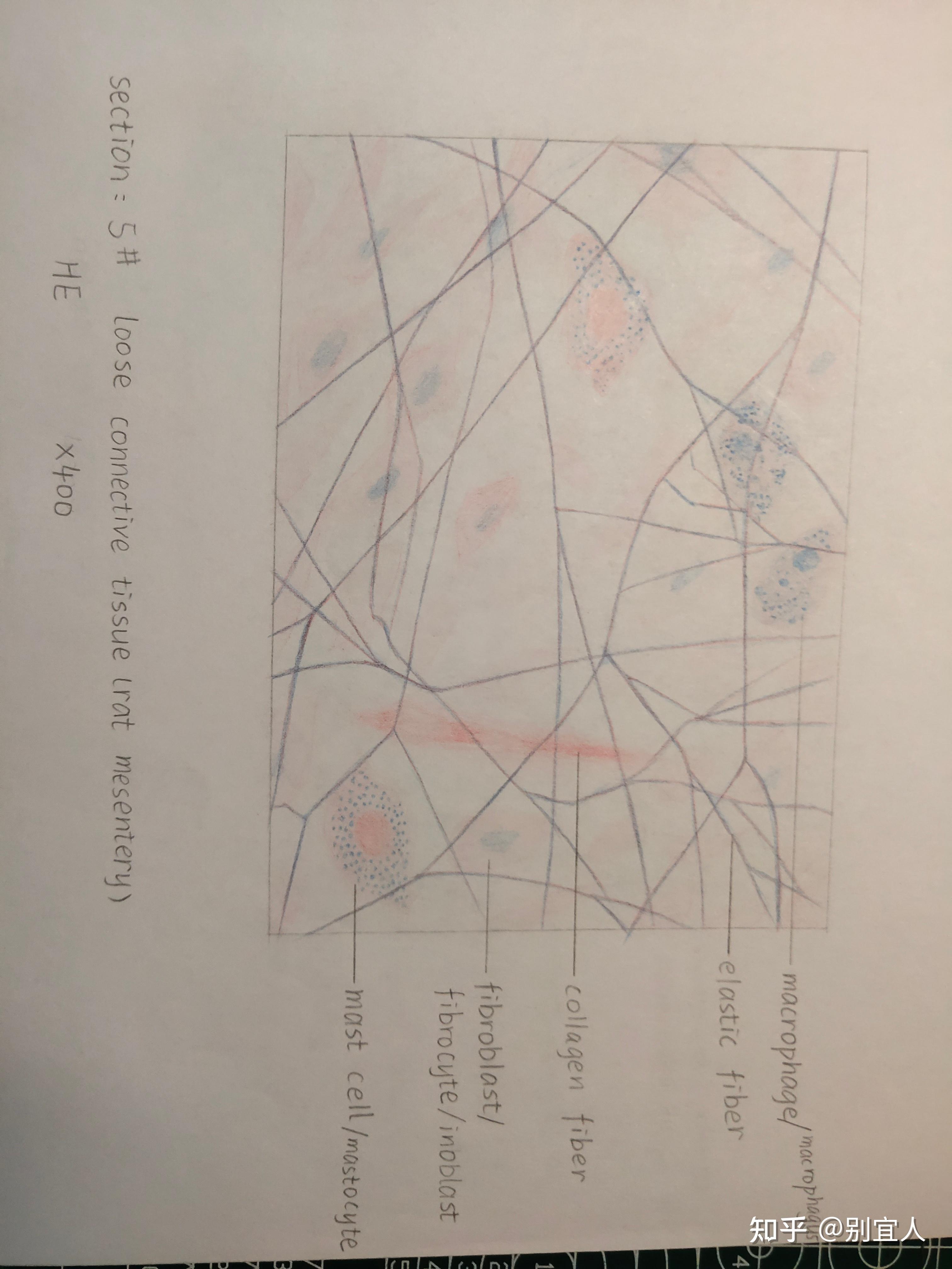 膀胱红蓝绘图图片