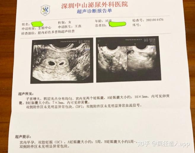 如果你是高龄备孕 卵巢早衰,就不能再错过这篇经验贴(本人高龄已孕)!