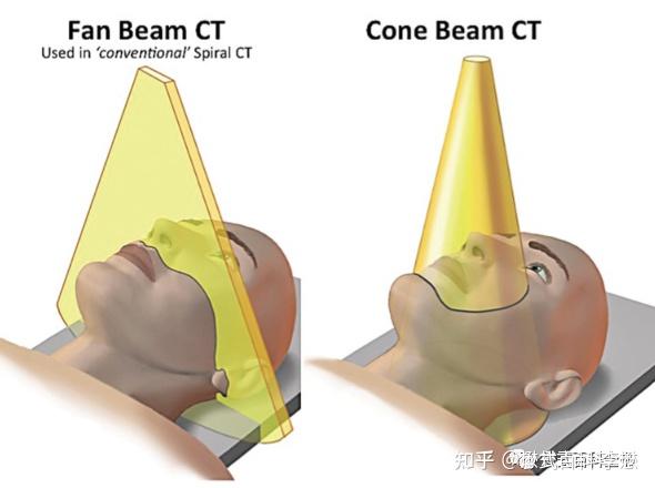 什么是CBCT？它和CT有什么区别？ - 知乎