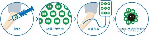 日本干细胞医院イケブクロクリニック 干细胞抗衰 Nk免疫细胞疗法 癌症治疗丨日本整容整形 知乎