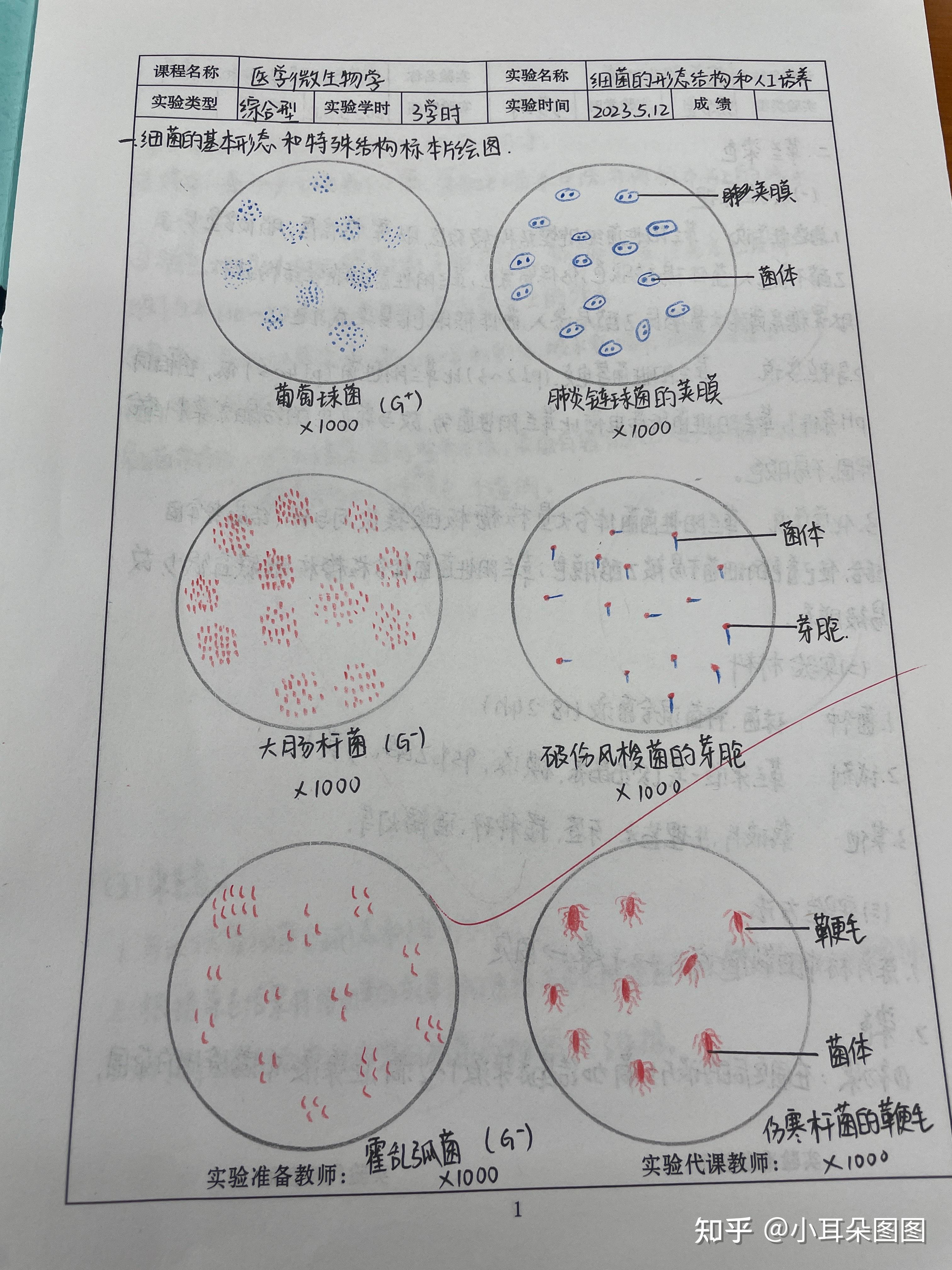 抗酸染色实验报告画图图片