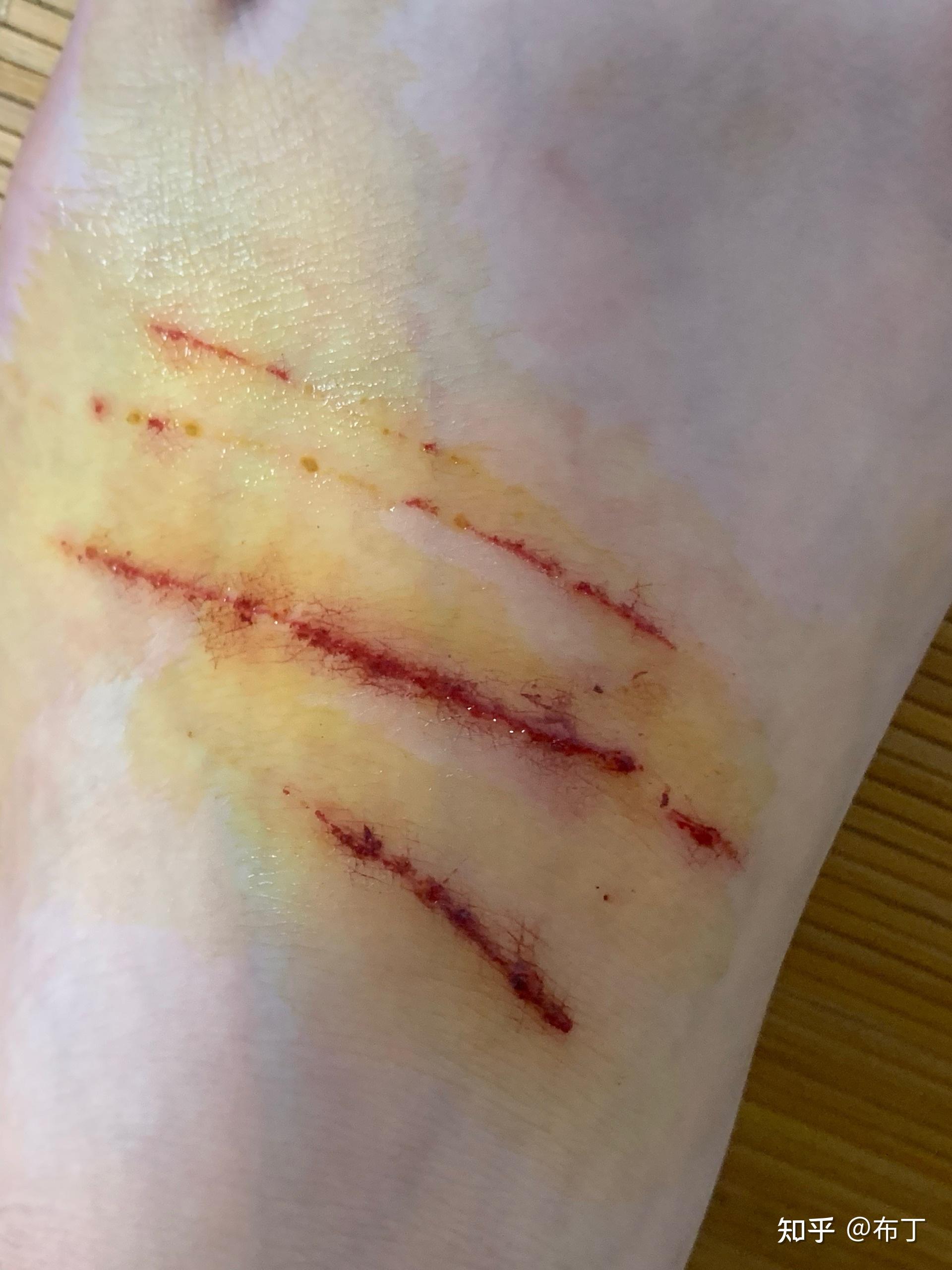 被家养的猫抓出血要打针吗? - 知乎