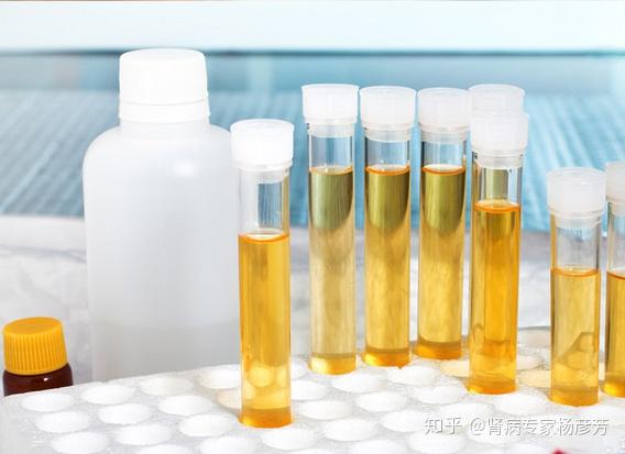 怎么测尿蛋白 v2-6d7ec039c5eb10d0a4b79b9150dc9970_r.jpg