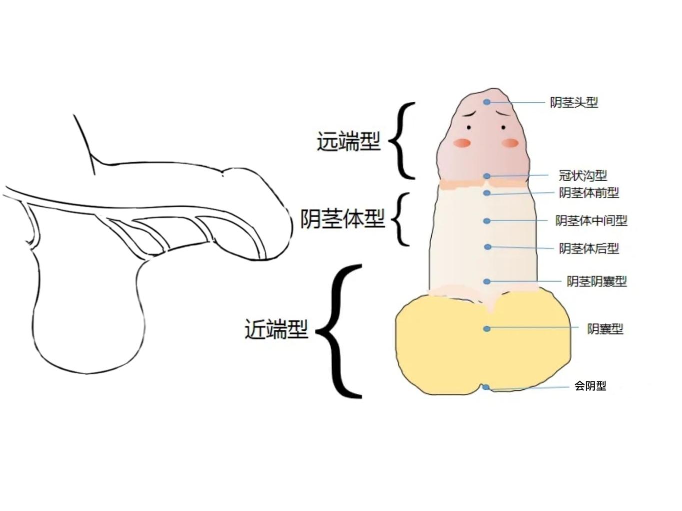 建议家长都看看男宝宝泌尿生殖系统的这些问题