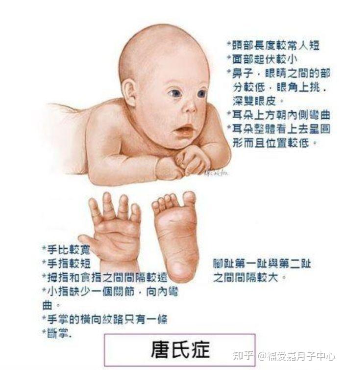 婴儿特殊面容图片