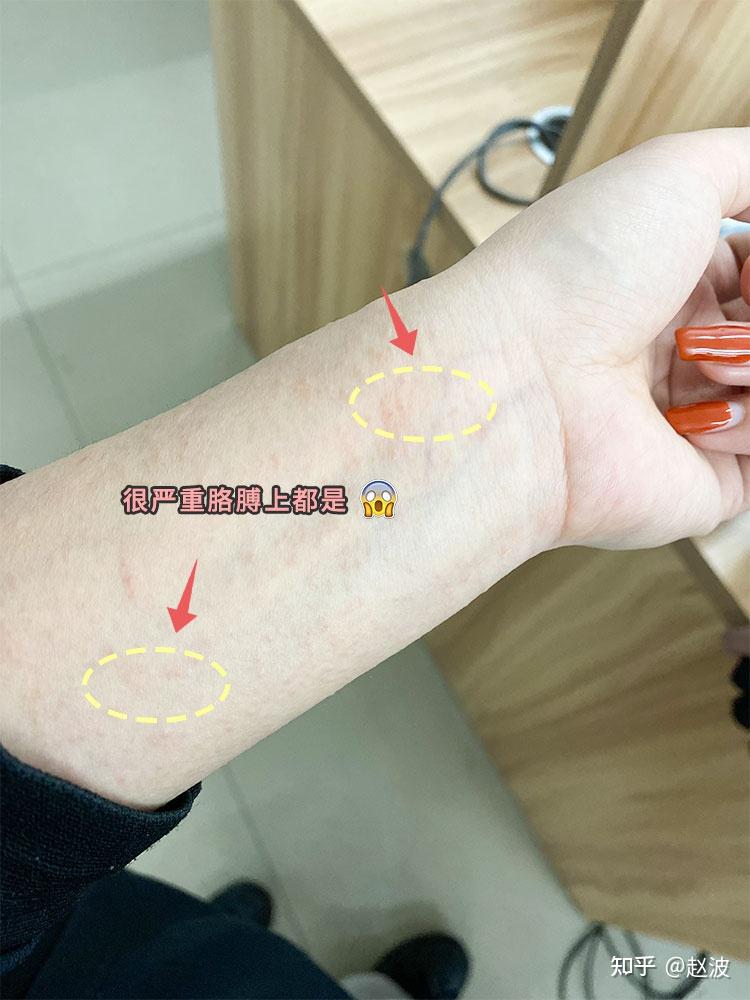 去除甲醛和装修异味最安全有效的方法是什么